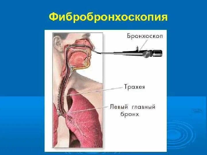 Бронхоскопия в Москве - цена на ФБС в клиническом Госпитале на Яузе